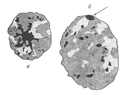  Рис. 74. Ядра клеток буккального эпителия человека: а - ядро без глыбки полового хроматина, б -- с глыбкой полового хроматина